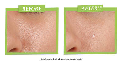 Close-up images of skin, showing a "before" on the left with visible pores and texture, and an "after" on the right with smoother, clearer skin. Text overlays indicate results from a 2-week consumer study.