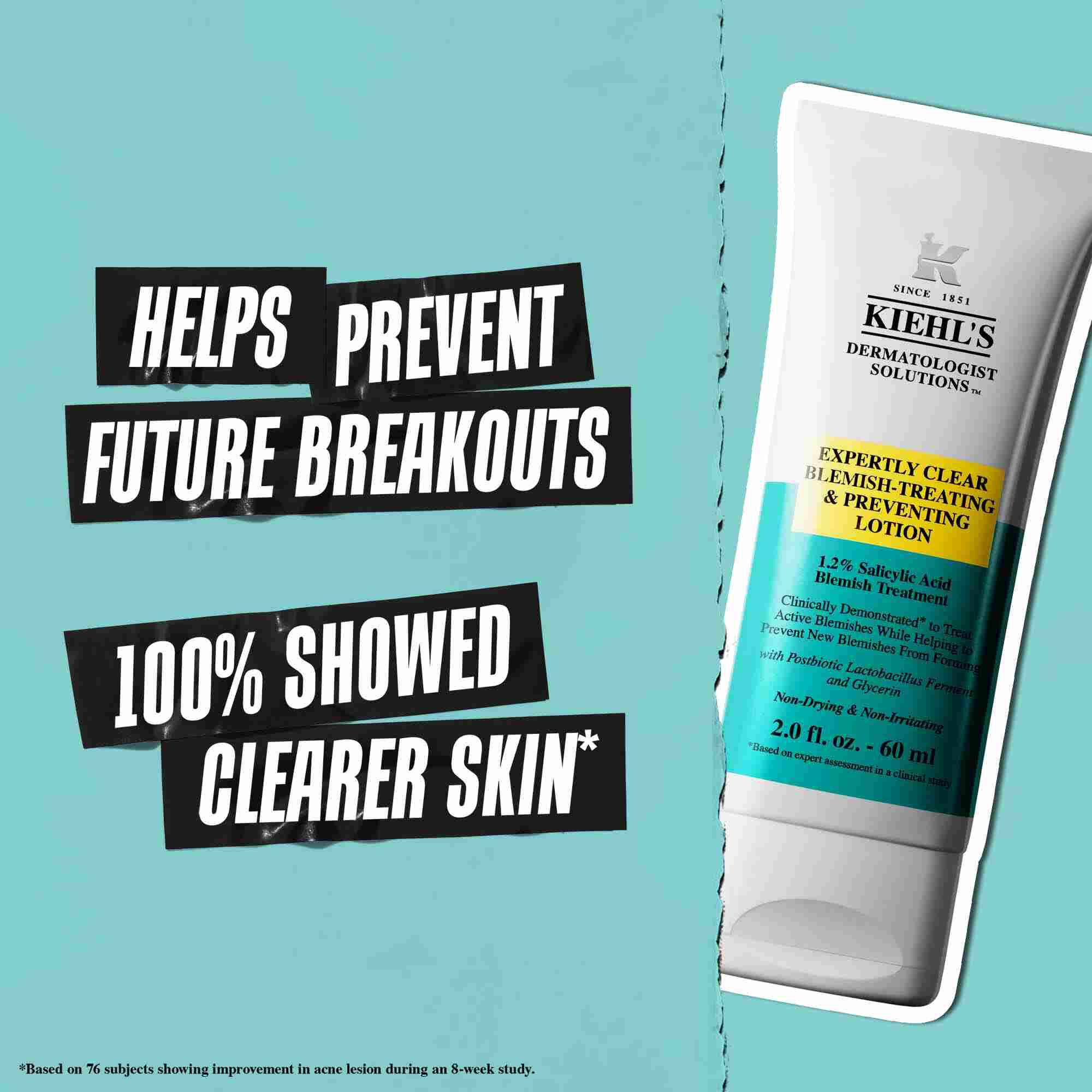 En tube Expertly Clear Blemish-Treating & Preventing Lotion mot en blå bakgrunn med teksten: "Bidrar til å forhindre fremtidige utbrudd" og "100 % viste renere hud."