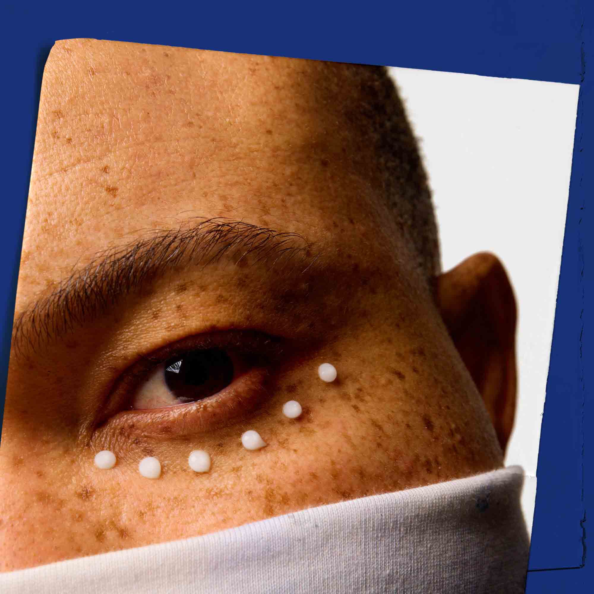 Naerbilde av huden rundt øyeområdet med prikker av Facial Fuel Eye Fuel.