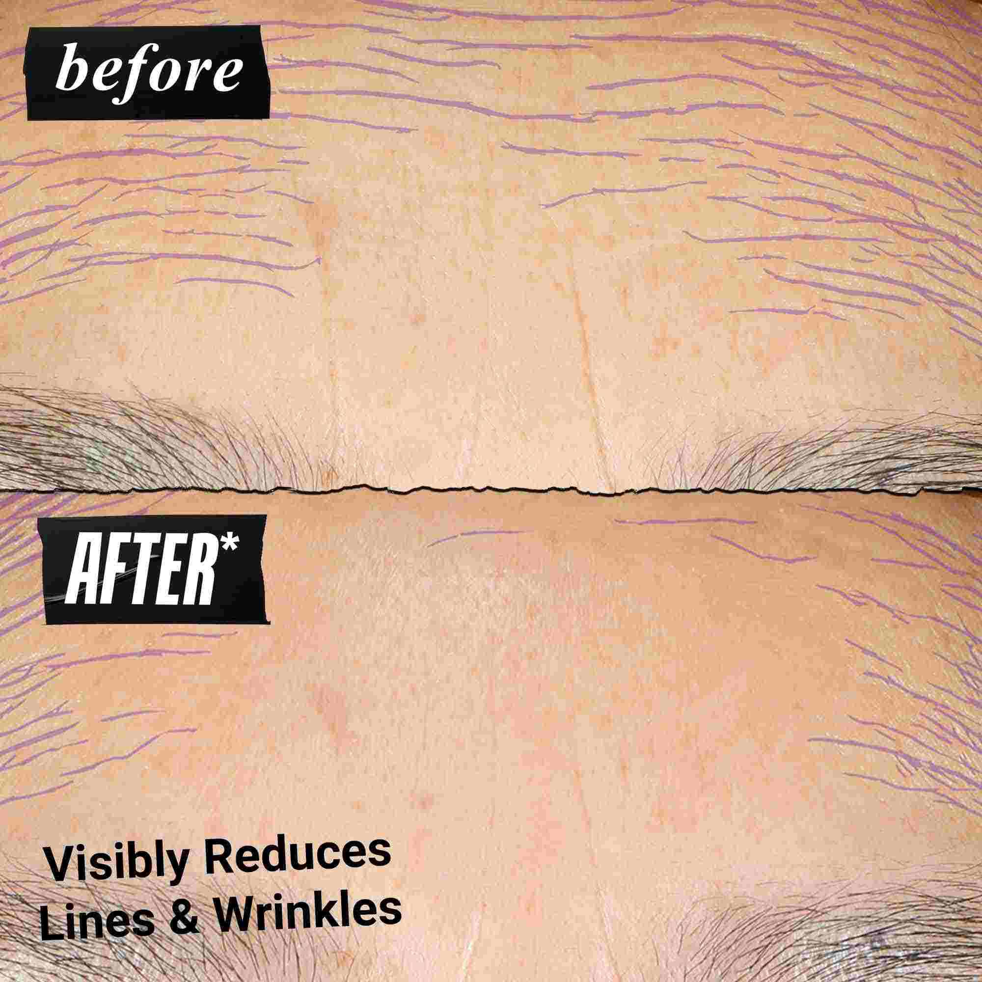 Før- og etterbilde – Kiehl's Retinol Skin Renewing Daily Microdose bidrar til å forbedre hudtone og tekstur