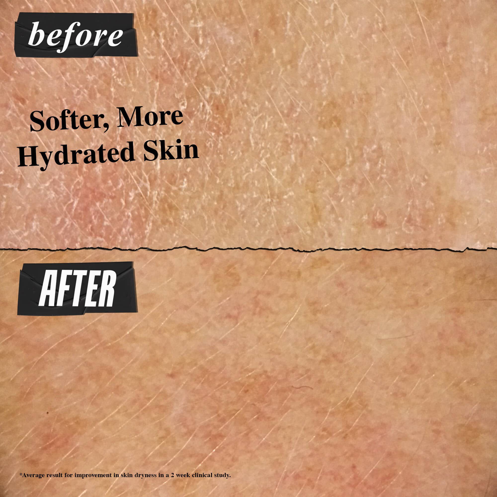 Før- og etterbilde – Ultra Facial Cream gir mykere og mer hydrert hud