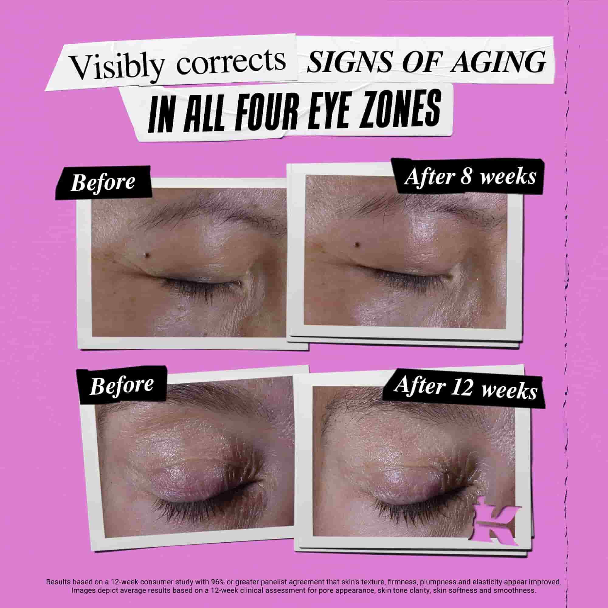 Før- og etterbilde av hvordan Kiehl's Super Multi-Corrective Eye Zone Treatment korrigerer alderstegn
