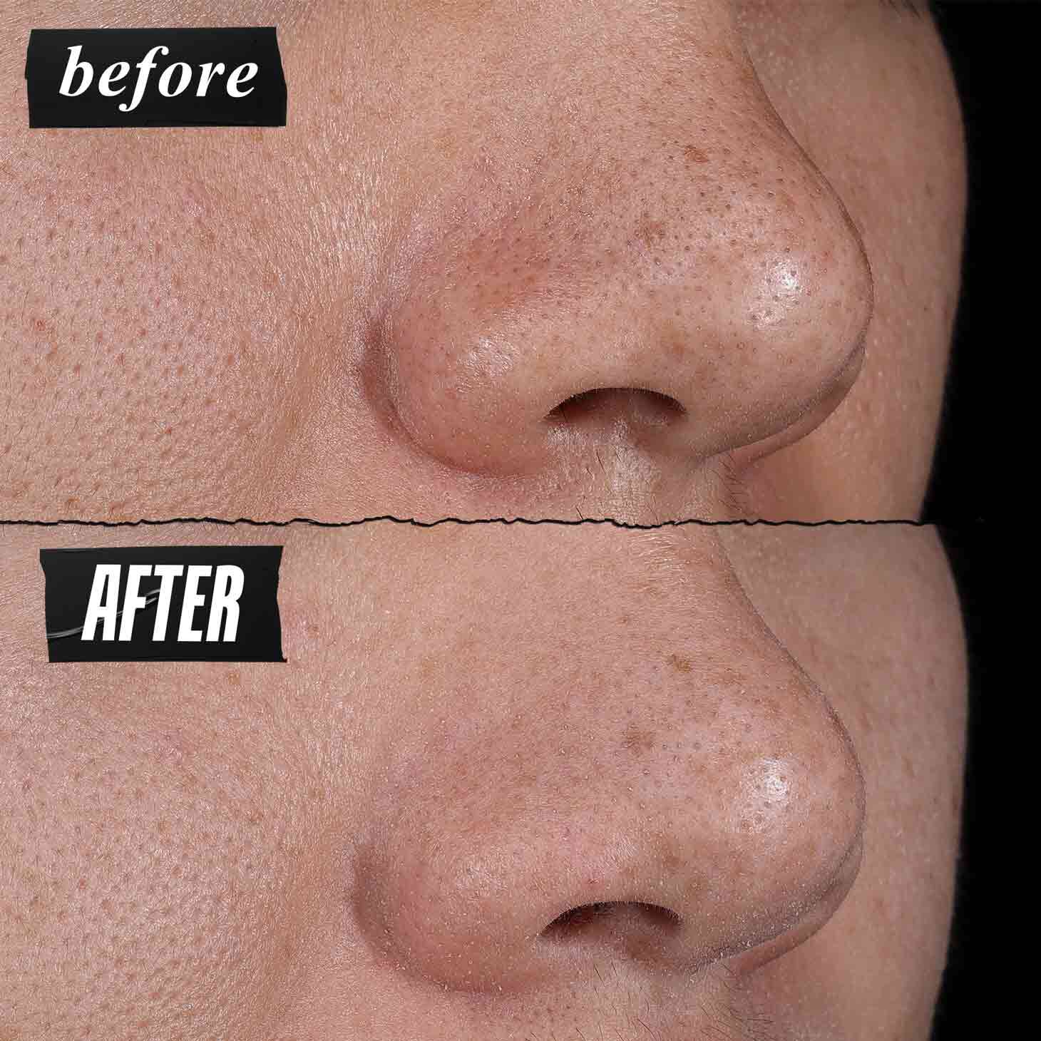 Før- og etterbilde – Kiehl's Rare Earth Deep Pore Cleansing Masque reduserer synlig porer