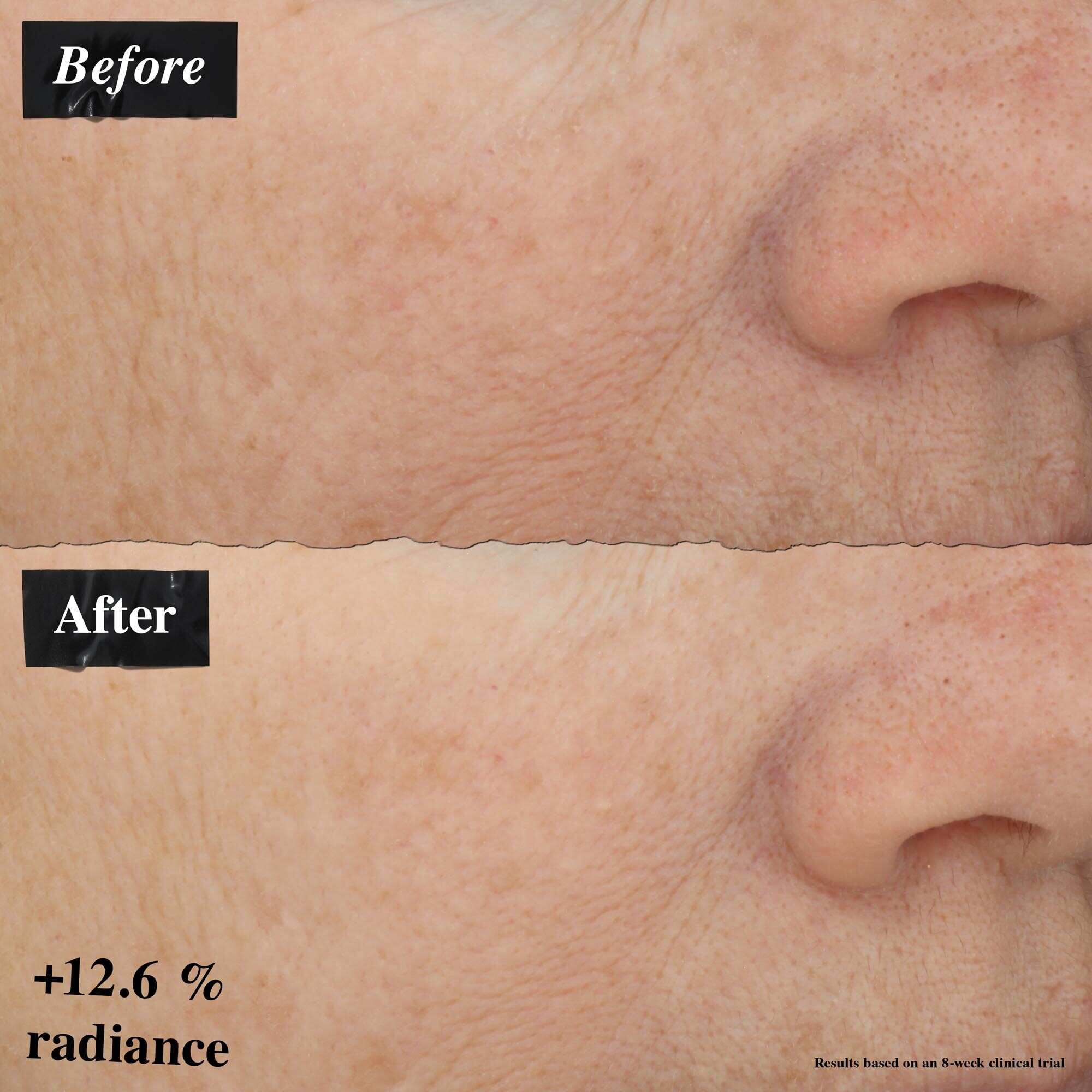 En før-og-etter bildesammenligning som viser forbedring i hudrødhet etter bruk av Powerful-Strength Line-Reducing Concentrate.