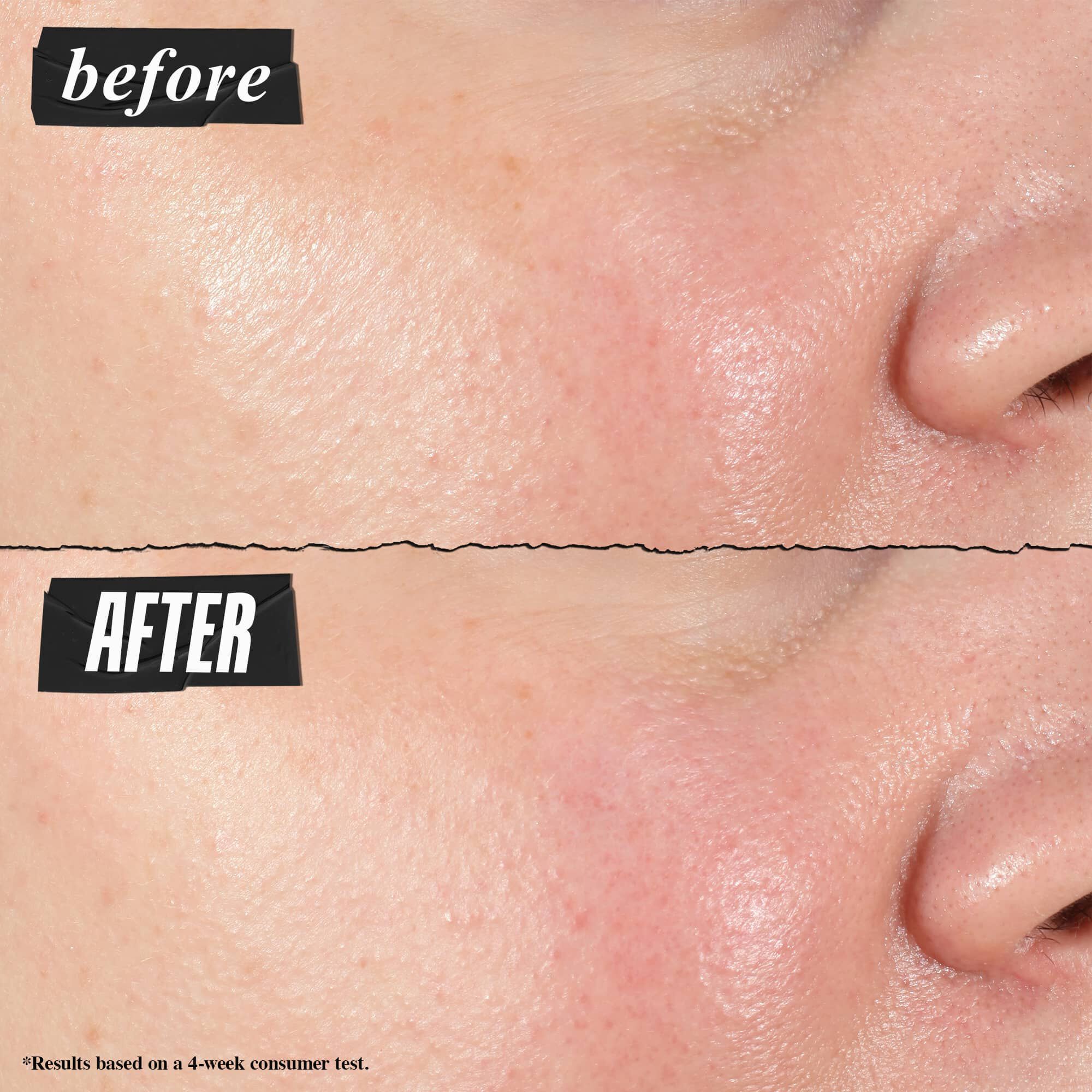 Før- og etterbilde – Kiehl's Hydro Plumping Serum Concentrate reduserer synlig porer