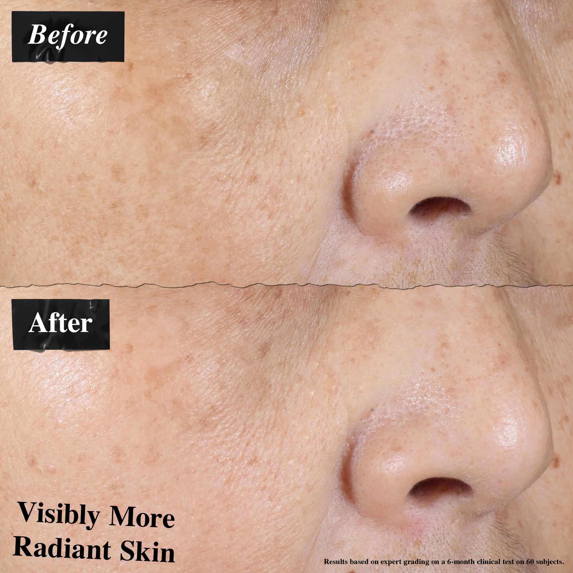 En før-og-etter-sammenligning som viser synlig redusert hudrødhet etter bruk av Ultra-Light Daily UV Defense.