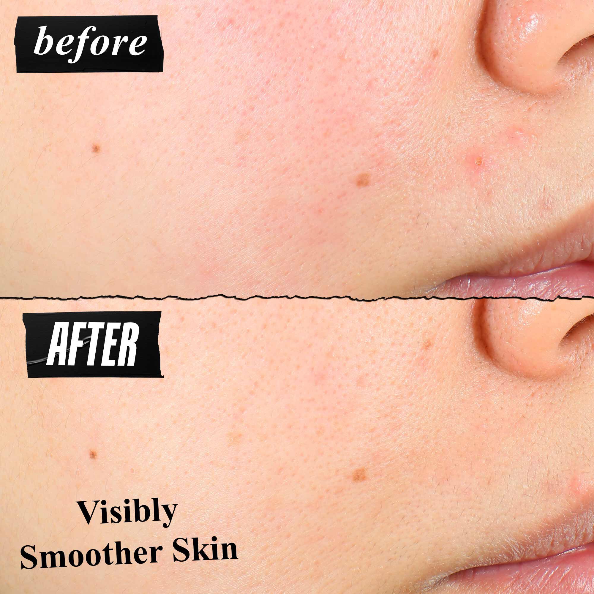 En før-og-etter-sammenligning av hudtekstur som viser synlig glattere hud etter bruk.