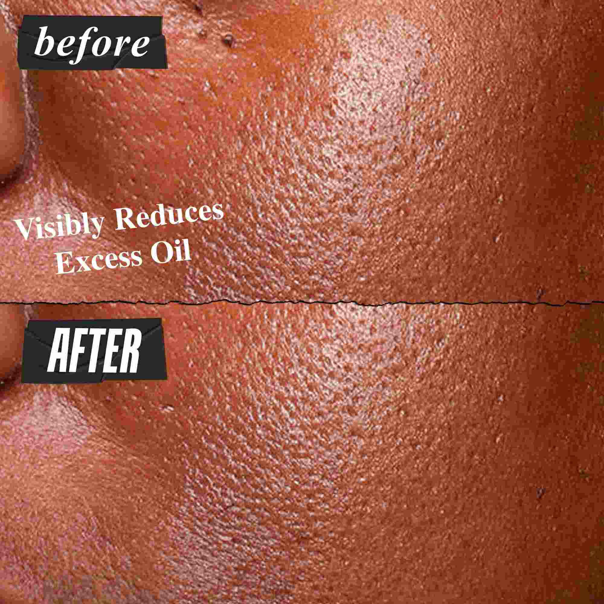 Før- og etterbilde av Kiehl's Ultra Pure High-Potency Serum som synlig reduserer overflødig olje