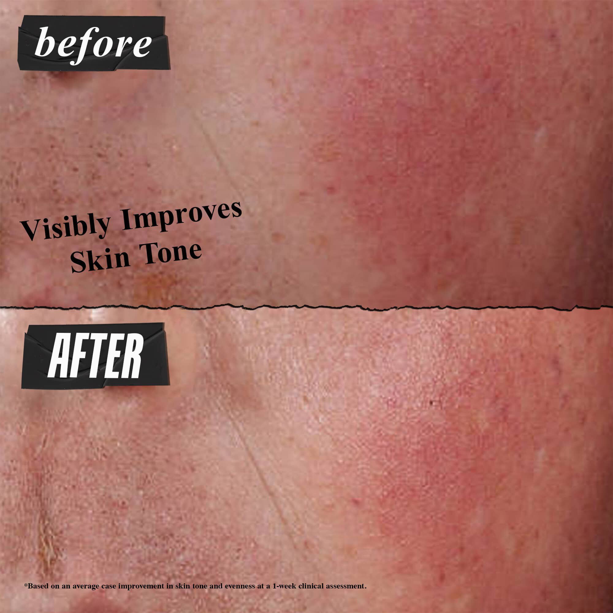 Før- og etterbilde – Kiehl's Ultra Facial Barrier Cream forbedrer synlig hudtonen