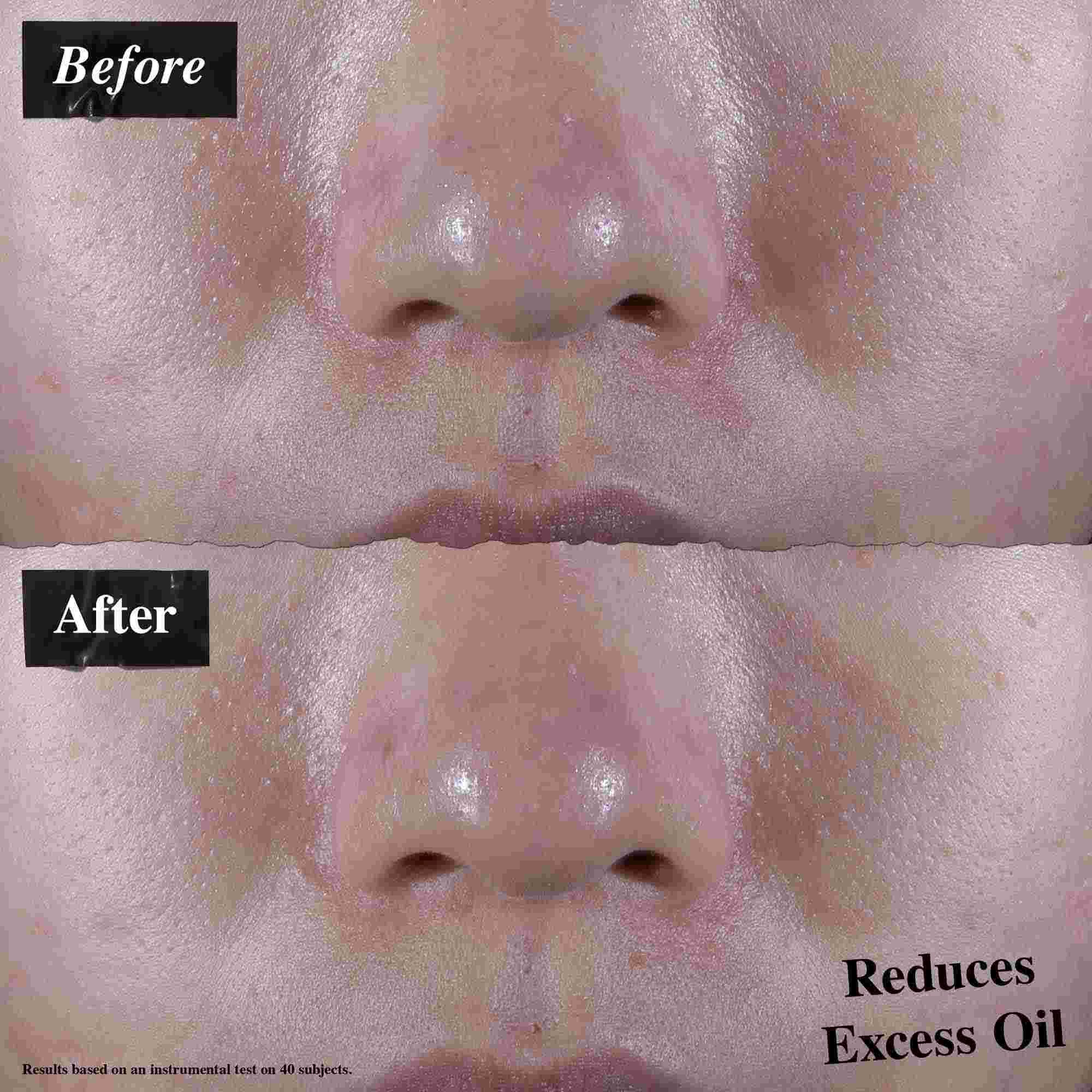 En før-og-etter-sammenligning som viser redusert overflødig olje etter bruk av Ultra Facial Oil-Free Gel Cream.