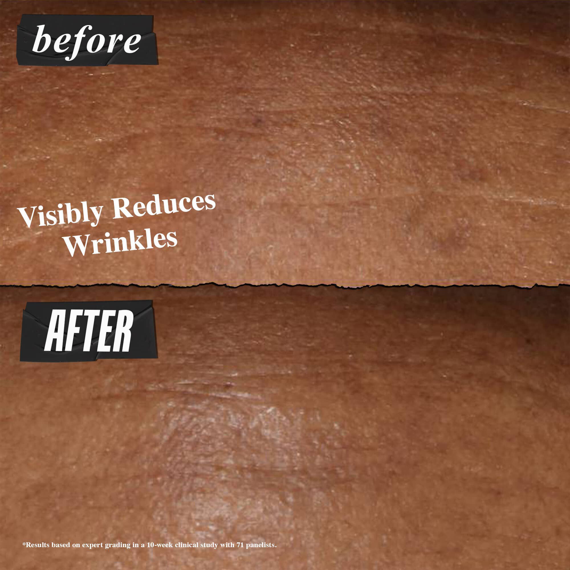 Før- og etterbilde – Kiehl's Retinol Fast Release Night Serum reduserer synlig rynker