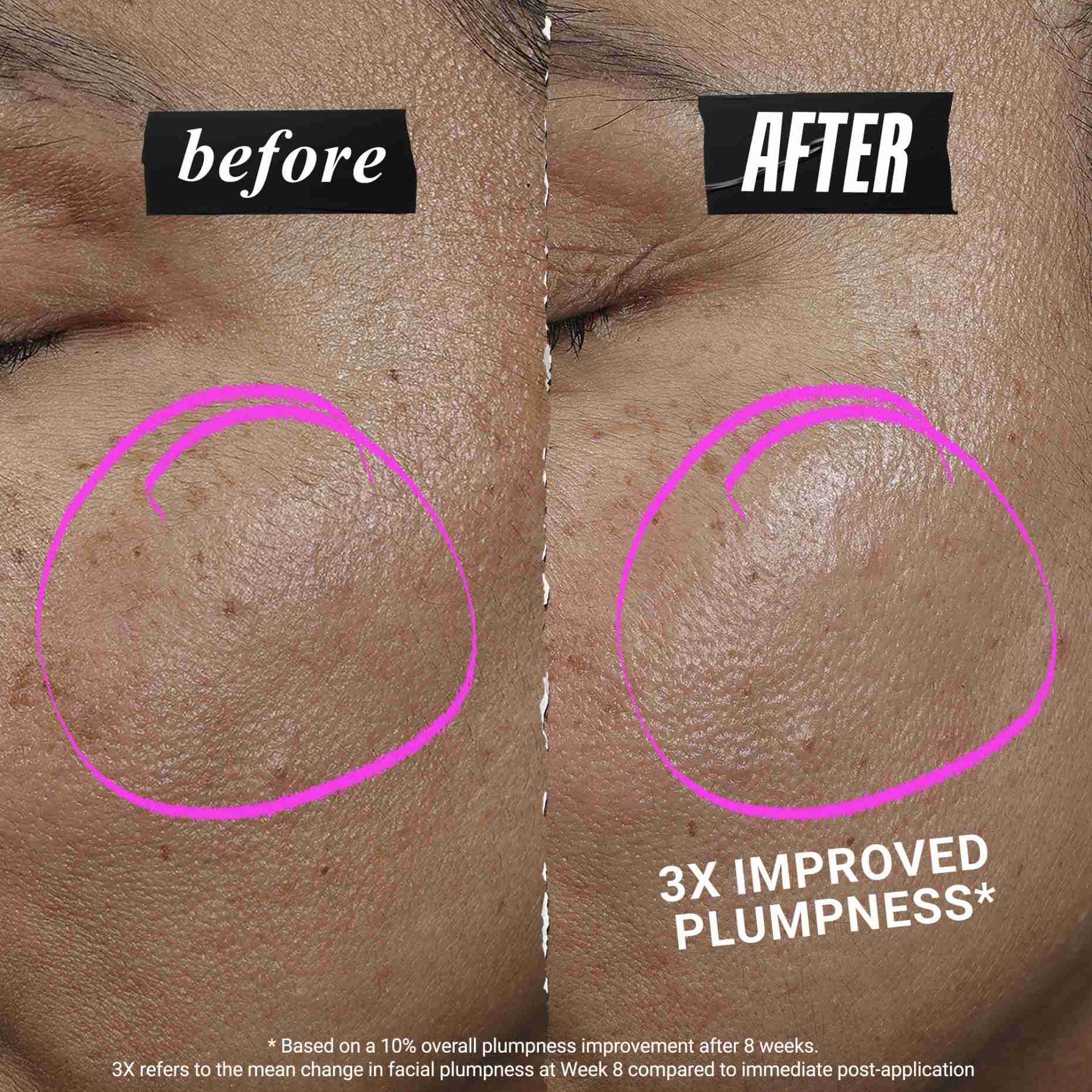1cc* CollaShot Plump Serum, Collagen Face Serum for løftet, fyldigere hud