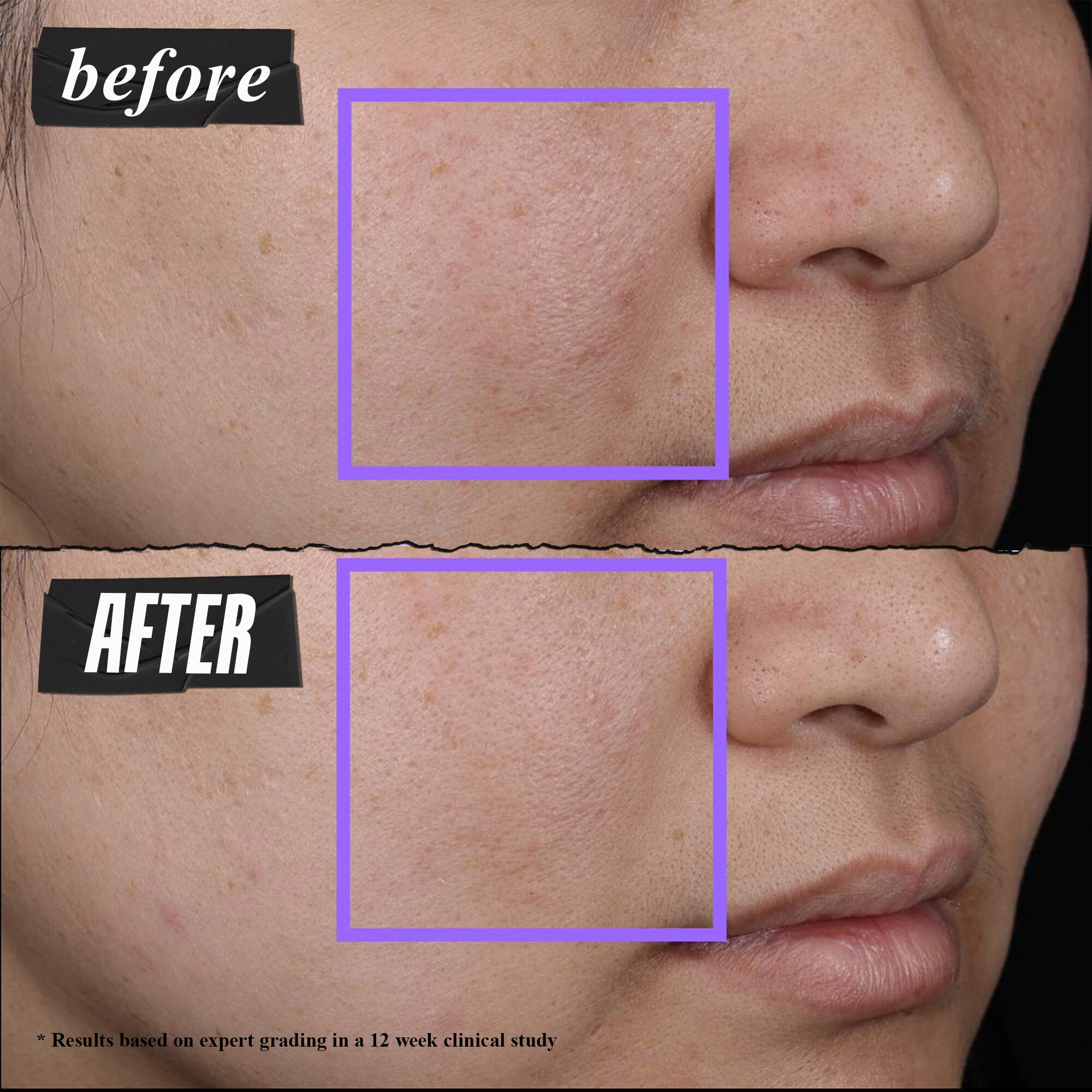 Clearly Corrective™ Clarity-Activating Soothing Emulsion